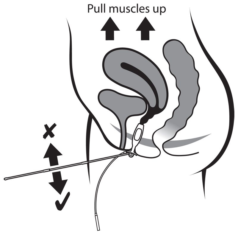 Sonda vaginal Periform - Imagen 4